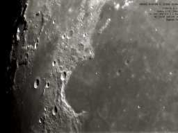 SINUS IRIDUM